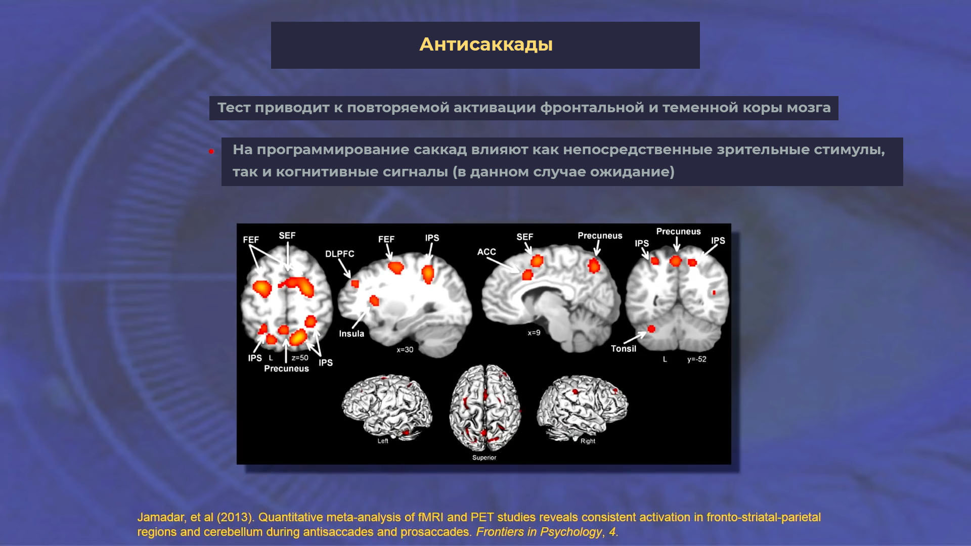 Синдром визуального снега картинки